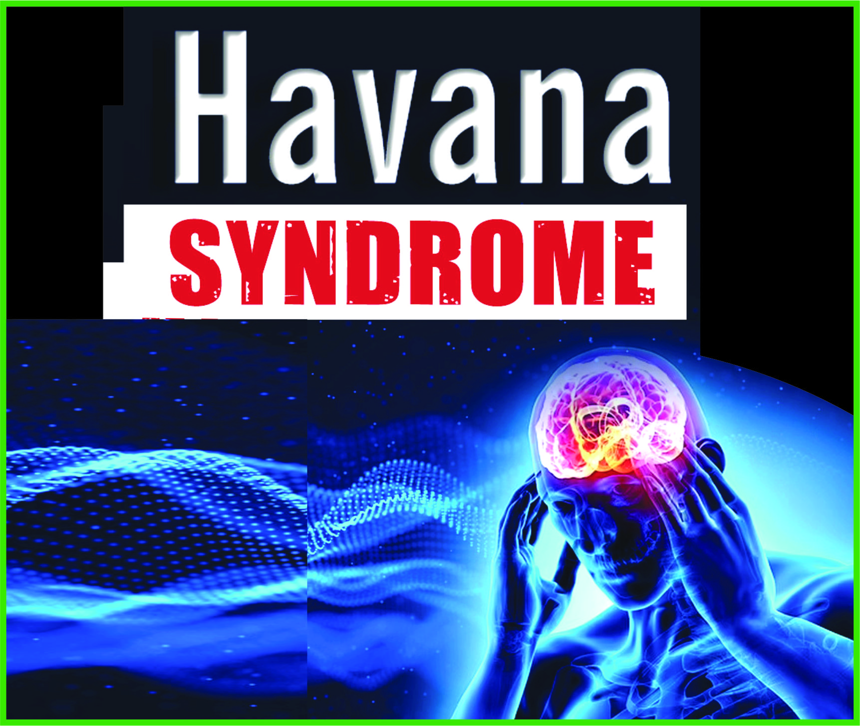 Read more about the article Havana Syndrome